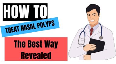 How To Treat Nasal Polyps - The Best Way Revealed 18 1688629089 maxresdefault