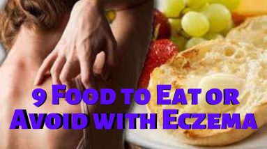 9 Food to Eat or Avoid with Eczema | Healthy eating 2 1688650652 maxresdefault