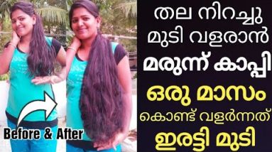 മുടി പെട്ടന്ന് വളരാൻ (മരുന്നുകാപ്പി)കൊഴിഞ്ഞു തീരാറായ മുടി ഒരു മാസം കൊണ്ട് വളർന്നത് ഇരട്ടി💥🔥 18 1688665715 hqdefault