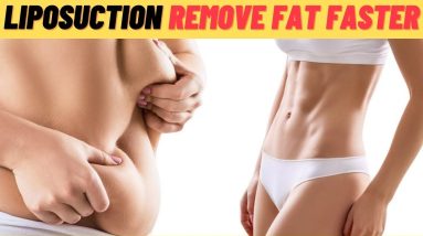 What is Liposuction - Fast Way of Removing Fat | liposuction consultation | lasik | Medical care 20 1688686709 maxresdefault