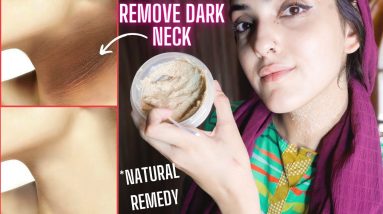HOW TO GET RID OF DARK NECK AT HOME NATURALLY *IN URDU STEP BY STEP | Immy 18 1688689356 maxresdefault