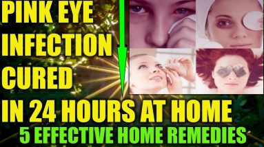 How To Cure Pink Eye Infection At Home In 24 Hours: Home Remedies For Conjunctivitis Eyes Infection 10 1688713262 maxresdefault