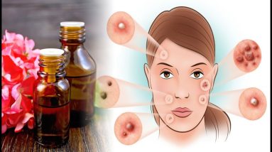 6 Incredible Benefits of Geranium Essential Oil 18 1688741846 maxresdefault