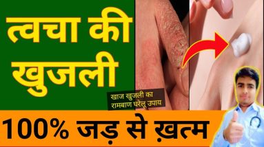 सिर्फ 3 दिन में कैसी भी दाख,खाज,खुजली हो हमेशा के लिए खत्म करने के 2 सफल उपाय || daad khaj khujli 8 1688825922 maxresdefault