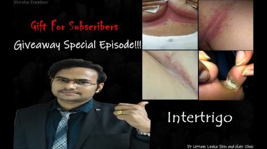 What is Intertrigo(infection of skin folds)?GIVEAWAY END!! 4 1688829567 maxresdefault