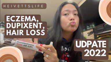 Eczema, dupixent, and hair loss update 2022 8 1688921627 maxresdefault