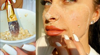 DIY CLEAR SKIN FACE MASK | How To Get Rid of Pimples + Acne Overnight At Home (100% Natural) 14 1688928671 maxresdefault