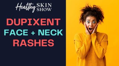DUPIXENT Face + Neck Rashes | Jennifer Fugo 20 1688936389 maxresdefault