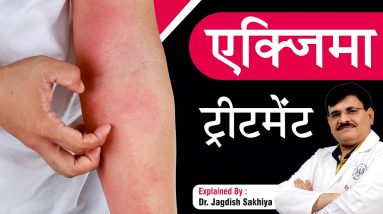 एक्जिमा ट्रीटमेंट Treatment | How to get rid of Eczema | Sakhiya Skin Clinic | Dr Jagdish Sakhiya 18 1688940075 maxresdefault