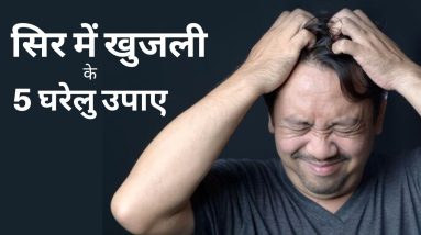 सिर में खुजली - 5 बड़े कारण | Itchy Scalp Problem | Treatment | Dr. Anil Garg 4 1688942603 maxresdefault