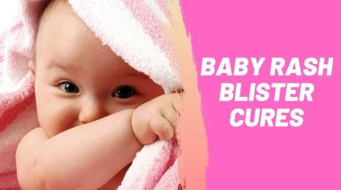 Baby Rash Blister Cures 18 1688943976 maxresdefault