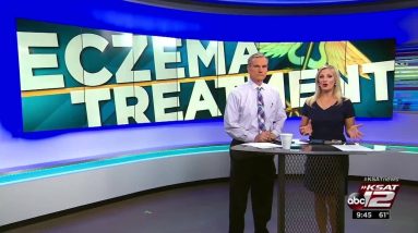 VIDEO: SA teen thankful for breakthrough eczema treatment 14 1688947415 maxresdefault