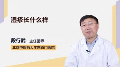 湿疹长什么样 段行武 北京中医药大学东直门医院 10 1688958614 hqdefault