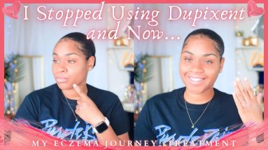 My Eczema Journey: Coping & Life Without Dupixent 3 weeks later | Skin Update + New Treatment! 12 1688987710 maxresdefault