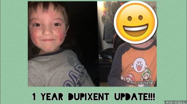 1 Year Dupixent Update #dupixent #eczema #cure 6 1689035416 maxresdefault