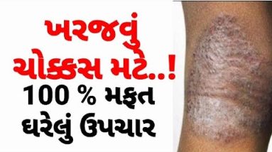 ખરજવું મટાડવા માટે | Eczema ka ilaj #kharajvu_Desi_Upchar#Gujaratihelthtips #GujaratiAyurvedicUpchar 18 1689094602 hqdefault