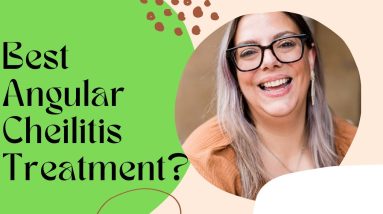 What is the Best Angular Cheilitis Treatment? 4 1689122854 maxresdefault