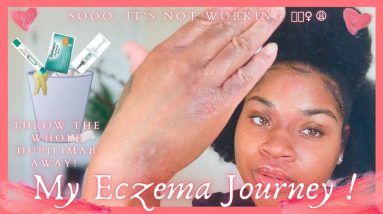 How I’m Getting My Chronic Eczema Under Control: Dupixent Journey | 3rd Injection + 2 Month Update 8 1689141735 maxresdefault