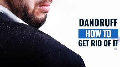 How To Get Rid Of Dandruff | Dandruff Causes & Treatment 12 1689151485 maxresdefault
