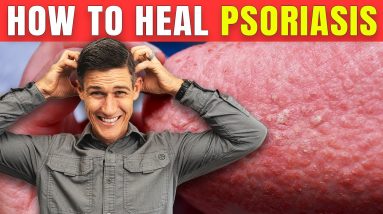 5 Keys to Handling Bad Emotions from Psoriasis and Autoimmune Issue 12 1689153145 maxresdefault