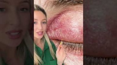 BEEZING TREND EXPLAINED 👀 @CarlyMusleh 16 1689166107 hqdefault