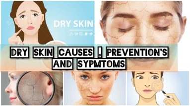 What is Dry skin||Dry Skin Causes||Symptoms||Prevention ||Avoid These Things|| #Dryskin #dryskincare 2 1689177904 maxresdefault