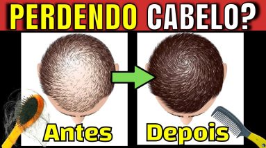 5 TRATAMENTOS PROVADOS CONTRA QUEDA DE CABELO| Remédios, Xampus e Vitaminas que FAZEM CRESCER CABELO 20 1689199099 maxresdefault