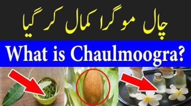 What is Chaulmoogra? | Amazing Benefits Chaulmoogra 10 1689207235 hqdefault
