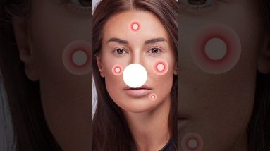 3 Teenage Skincare Mistake ❌️ | Skincare Mistake Teenagers Must Avoid | #shorts #skincare 4 1689213745 maxresdefault