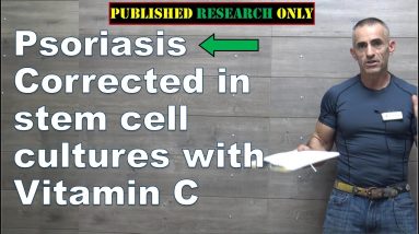 Psoriasis Corrected in stem cell cultures with Vitamin C 2 1689217398 maxresdefault