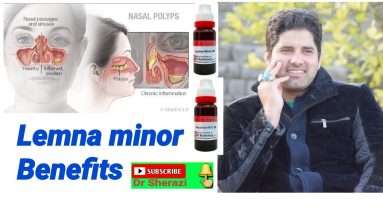 Lemna minor uses & Sign symptoms? Homeopathic medicine for nasal polyps and treatment? 10 1689237497 maxresdefault