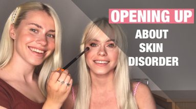 WHAT IS MAKEUP LIKE WHEN YOU SUFFER WITH A SKIN CONDITION | MONIKA BEAUTY 6 1689280530 maxresdefault