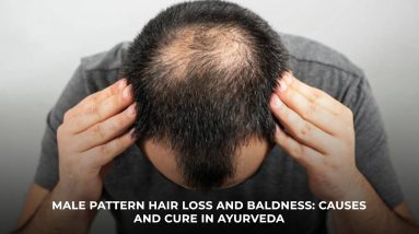 Understand the hair loss pattern before buying any new product I MEN HAIR HEALTH (Science+ Ayurveda) 8 1689334542 maxresdefault