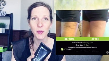 What is the Difference between Stretch Mark Cream and Defining Gel 6 1689335409 maxresdefault