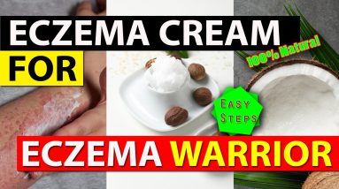 Eczema Battle: Conquer Your Skin with our Powerful Cream Challenge Naturally #eczema #eczestop 8 1689336506 maxresdefault