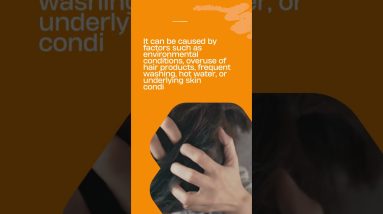 ladies beauty problems which they face in their daily life Dry and itchy scalp 10 1689352965 maxresdefault