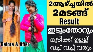 ഞാൻ എന്റെ ഉള്ളിലാത്ത മുടി വളർത്തിയെടുത്തത് ഇങ്ങനെ..!എത്ര ഉള്ളിലാത്ത മുടിയുംഉള്ള് വക്കും ഇങ്ങനെ ചെയ്ത 18 1689358540 hqdefault