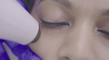 Say goodbye to Dark Circles | Armoraa | Responsible Dermatology | 8 1689404405 maxresdefault