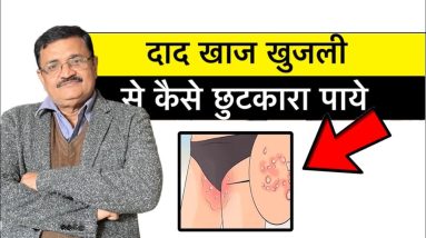 दाद खाज खुजली अब दोबारा जीवन में नहीं होगी | जड़ से कैसेक ख़त्म करे दाद खाज खुजली allergy  2 1689409863 maxresdefault