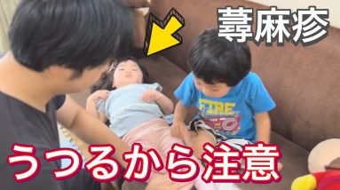 風邪から免疫力低下!蕁麻疹が4歳の兄から2歳の妹にも移った【Immunity weakened by cold】 4 1689424082 maxresdefault