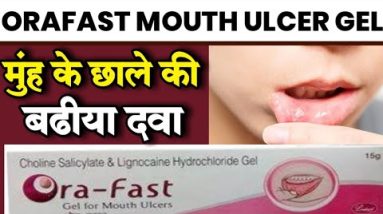 orafast mouth ulcer gel| मुँह में घाव |और छालों से दिलाये तुरंत राहत|orafast uses,side effect 2 1689427770 hqdefault