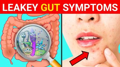 Leaky Gut : 10 Signs and Symptoms of Leaky Gut Syndrome | ( Gut Health ) || Leaky Gut Symptoms 14 1689434216 maxresdefault