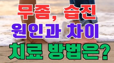#무좀, 습진의 원인과 차이 구별, 치료 방법, 무좀과 습진은 다른 질병이므로 각각의 질병에 대한 관리 방법이 다릅니다. 2 1689505287 maxresdefault