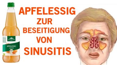 Wie du eine Sinusitis innerhalb von Minuten mit Apfelessig los wirst! 20 1689751237 maxresdefault