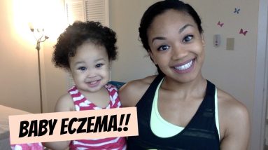 Baby Eczema Update | Skin Care 2016 14 1689777041 maxresdefault