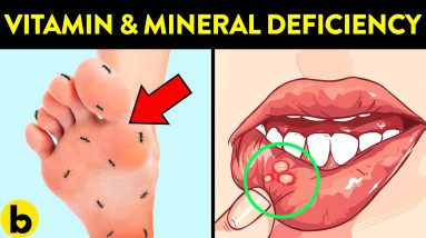 6 Signs That You May Have Vitamin And Mineral Deficiency 18 1689785612 maxresdefault