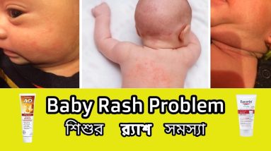 ডায়াপার রেশ প্রতিরোধ শিশুর ত্বকের যত্নে/শিশুর শরিরে রেশ Baby Rash Problem 18 1689815425 maxresdefault
