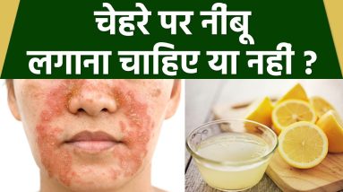 Face पर Lemon लगाने से क्या होता है | चेहरे पर नींबू लगाने से क्या होता है | Boldsky *Health 16 1689819091 maxresdefault