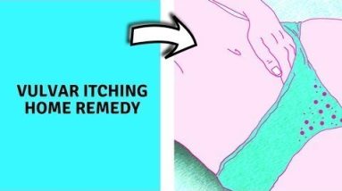 10 Home Remedies for an Itchy Vagina, and When to See a Doctor | vulvar itching home remedy 10 1689830119 hqdefault