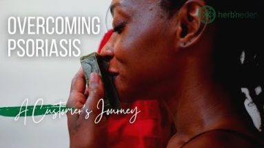 A Customer Journey On Overcoming Psoriasis | Psoriasis Awareness Month 16 1689952508 hqdefault